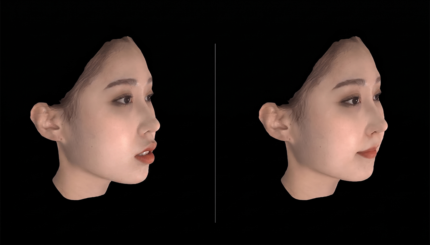 교정 전과 교정 후 예상 모습을 나란히 보여주는 3D 시뮬레이션 화면